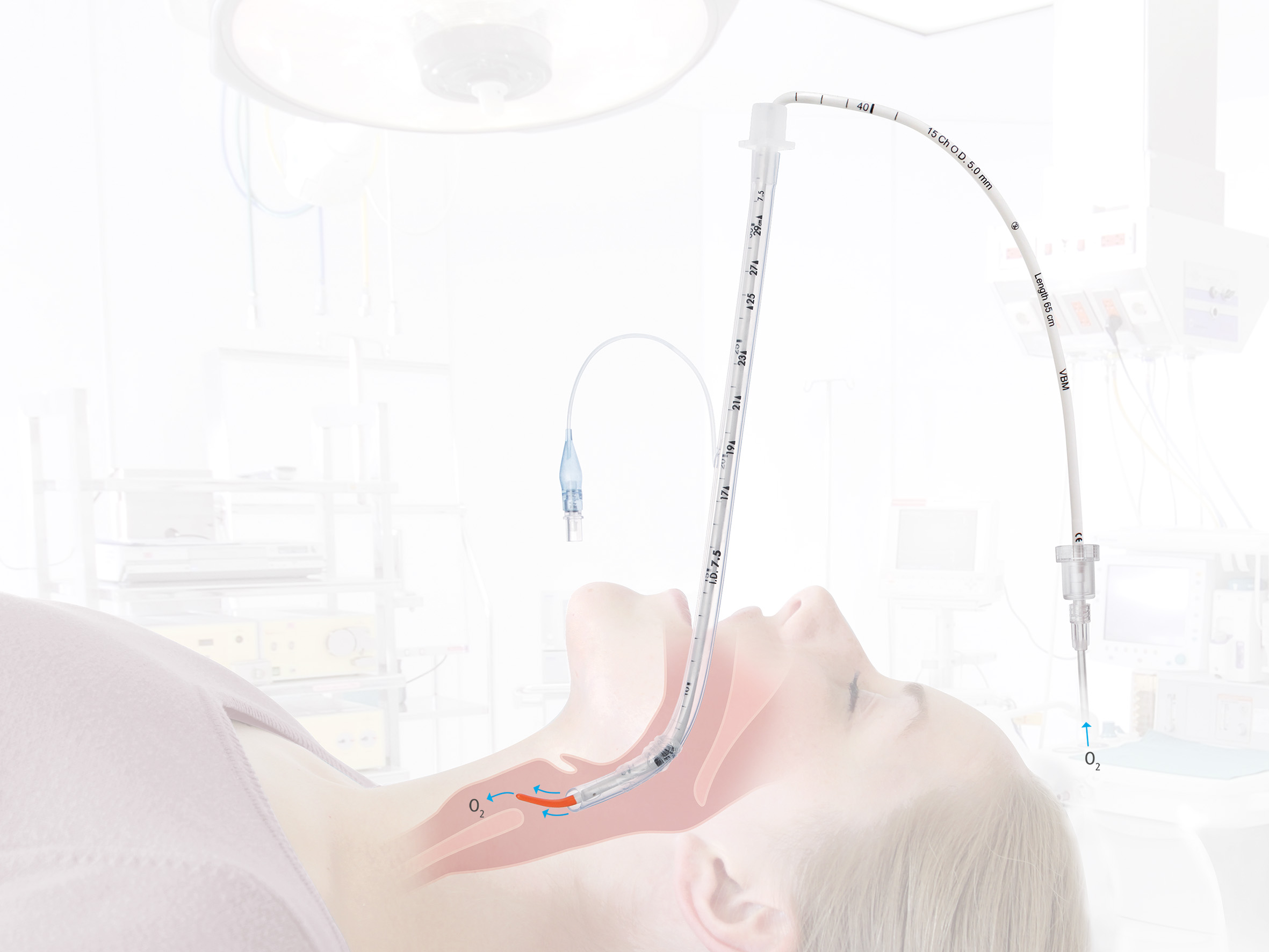 S-Guide Intubationshilfe mit O2-Konnektor - Packung à 5 Stück
