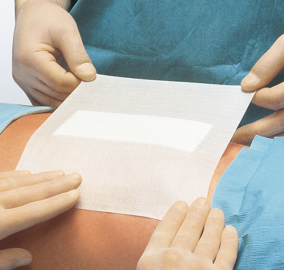 Fixomull Hyperallergener Klebemull - **B-WARE**